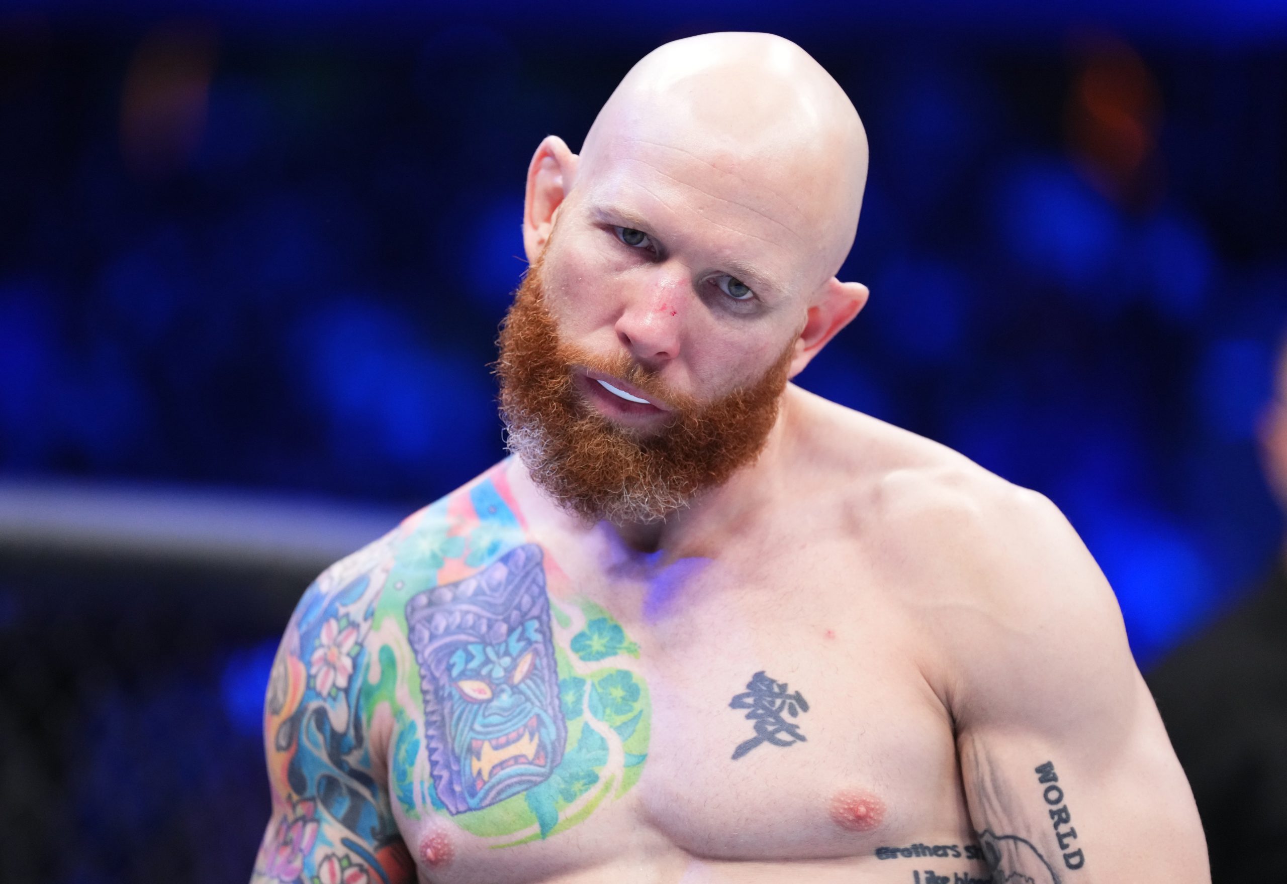 Josh Emmett prepares to fight Yair Rodriguez of Mexico in the UFC interim featherweight championshi...